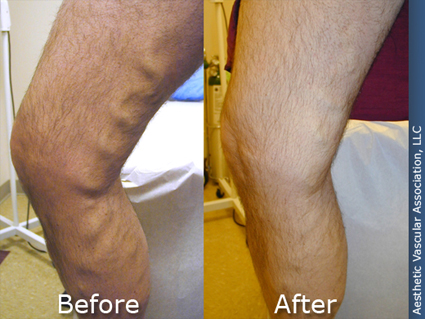 before-after-11